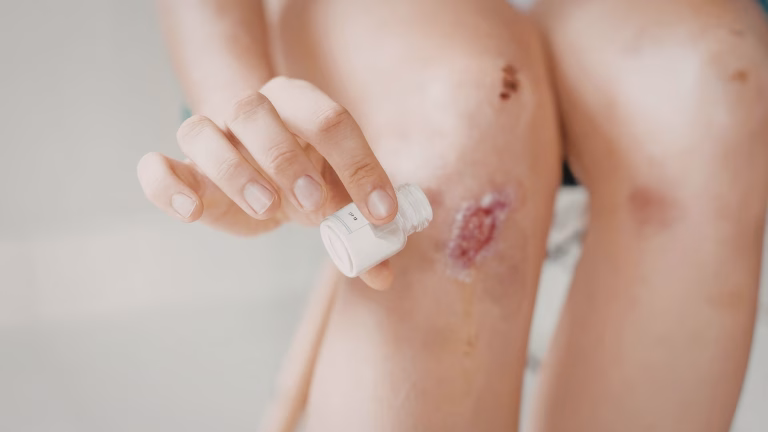 5 Ways Skin Debridement Promotes Faster Wound Healing